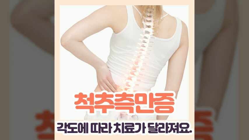 대구 척추측만증 병원 교정치료 각도에 따라 다르게