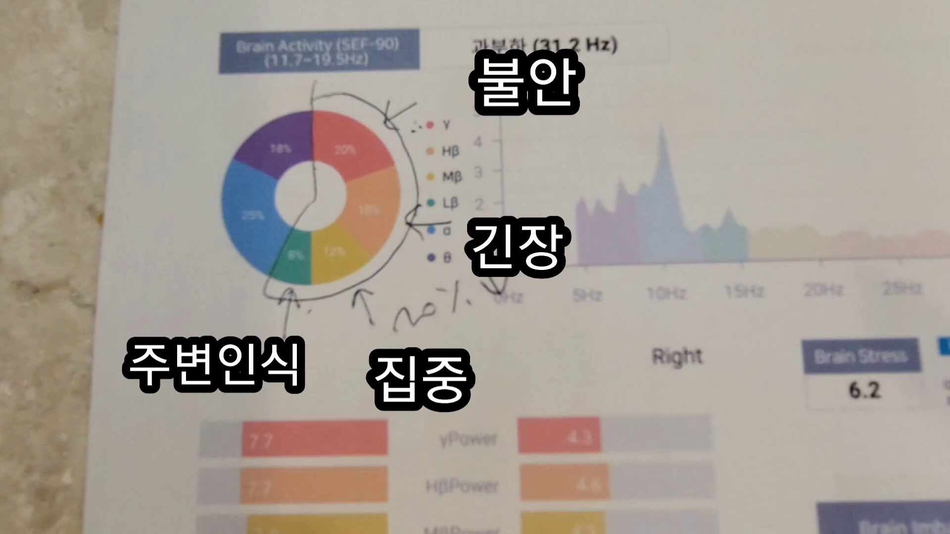 압구정한의원 자율신경 검사 교감신경 부교감신경 뇌파