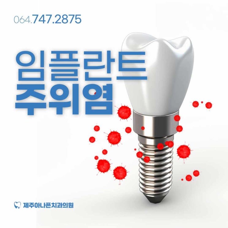  제주시 치과 임플란트 주위염