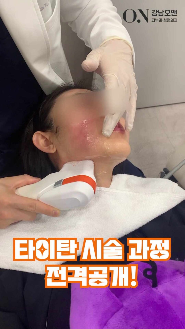  탄력을 회복 하고싶으신가요? 강남역 피부과 오앤의원에서 타이탄리프팅으로 예뻐지세요!