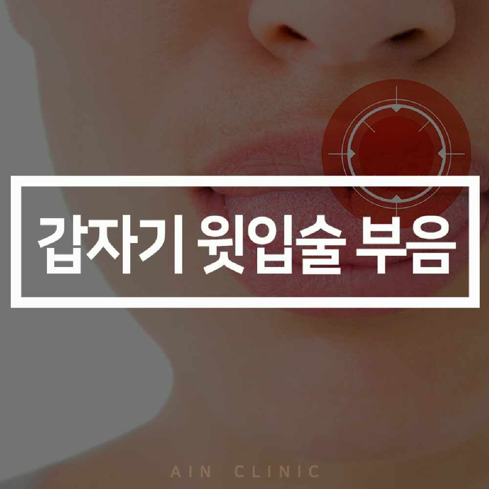 갑자기 윗입술 부음 원인은 구순염? 4가지 이유