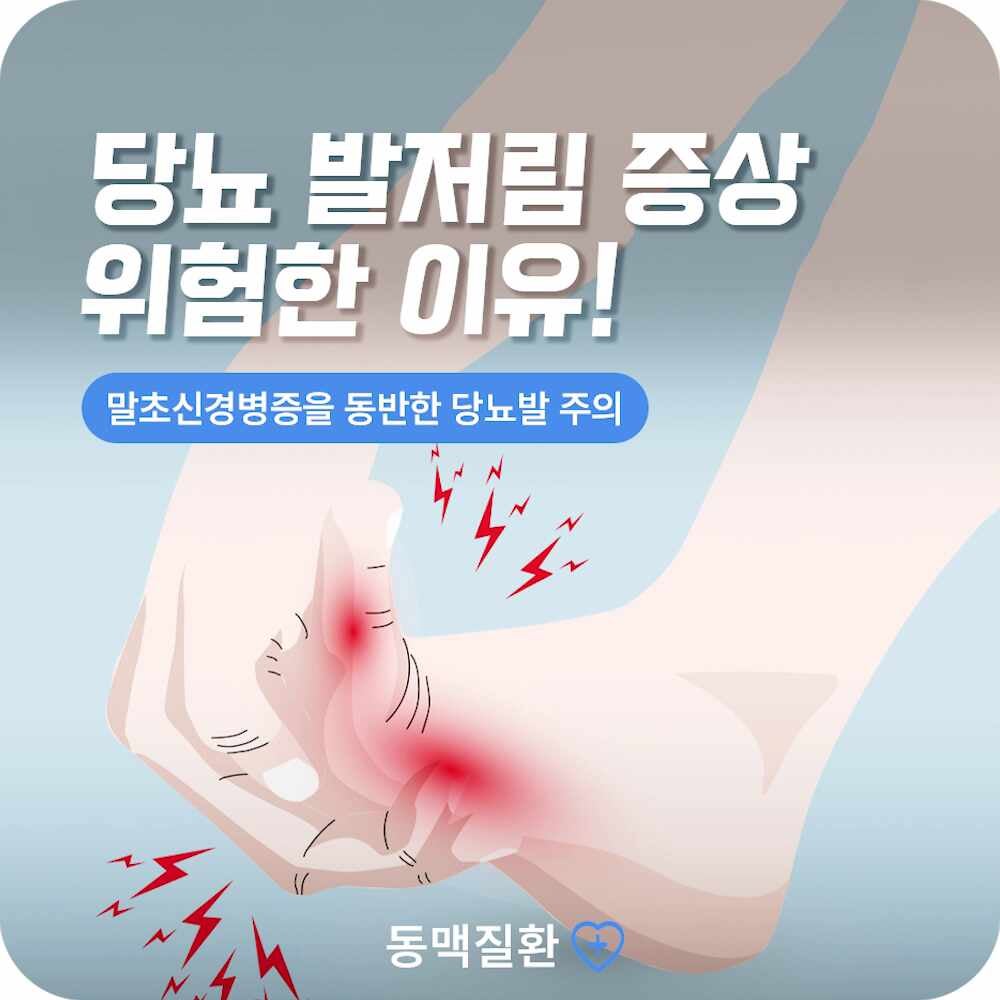 부산 당뇨 발저림 증상 놓치면 족부 절단 위험 '당뇨발'