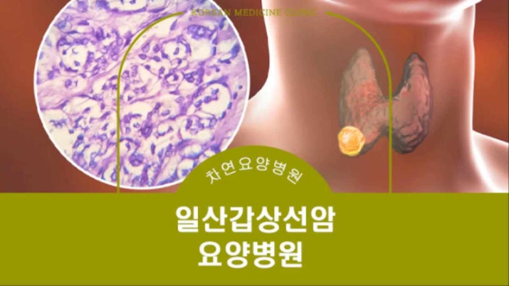  일산 갑상선암 방사성동위원소 격리 입원 요양병원