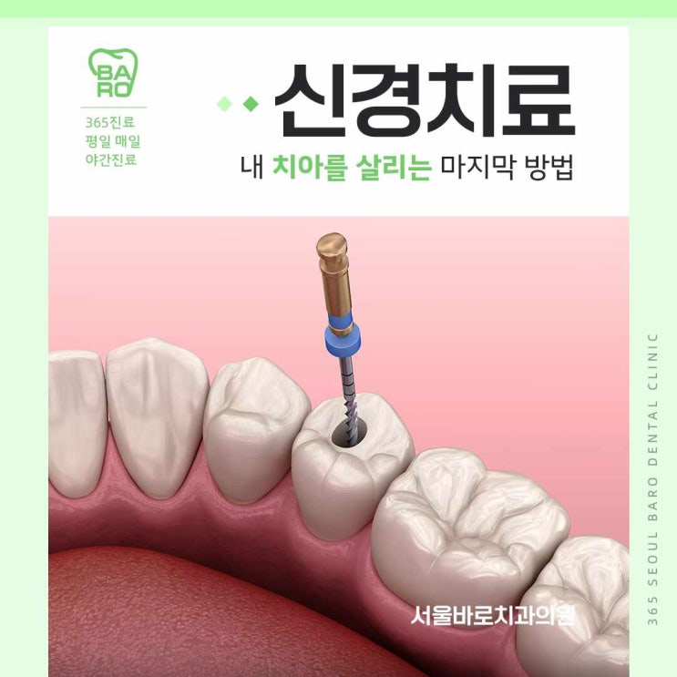  강동구공휴일진료치과 내 치아를 살리는 신경치료