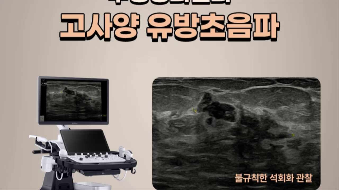 대전유방검사, 유방암 여의사 진료하는 곳!