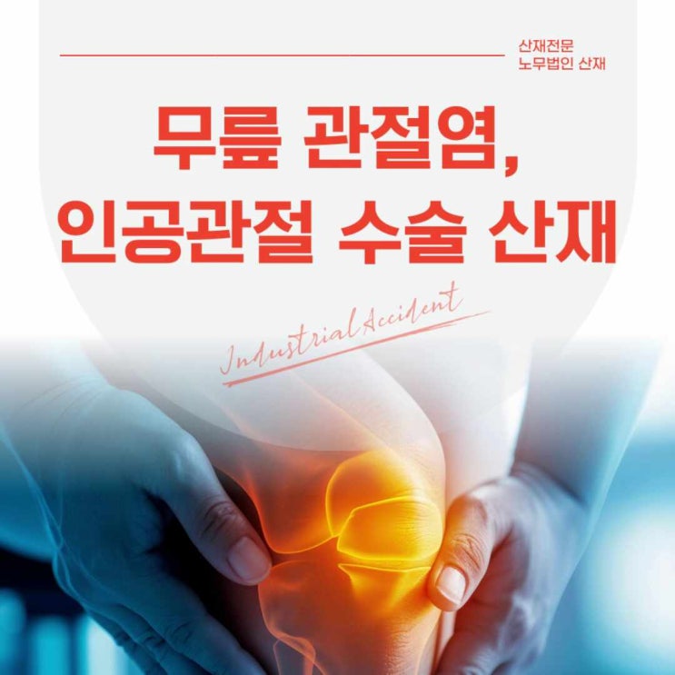  산재노무사 무릎 관절염 인공관절 수술 산재 6급 승인