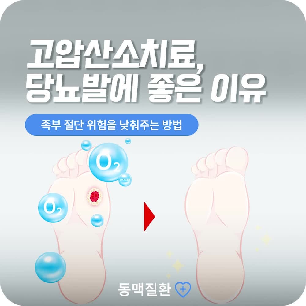 부산고압산소치료 당뇨 환자 불안 줄여주는 당뇨발 치료법
