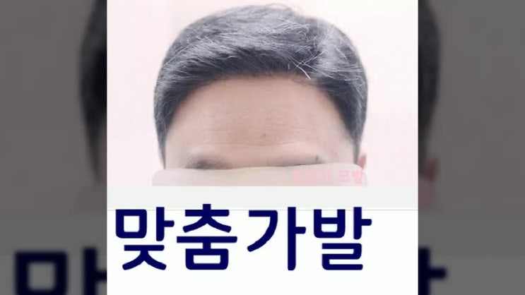  종로가발 서대문 중구 남자 맞춤가발 앞머리 정수리부분 통 항암
