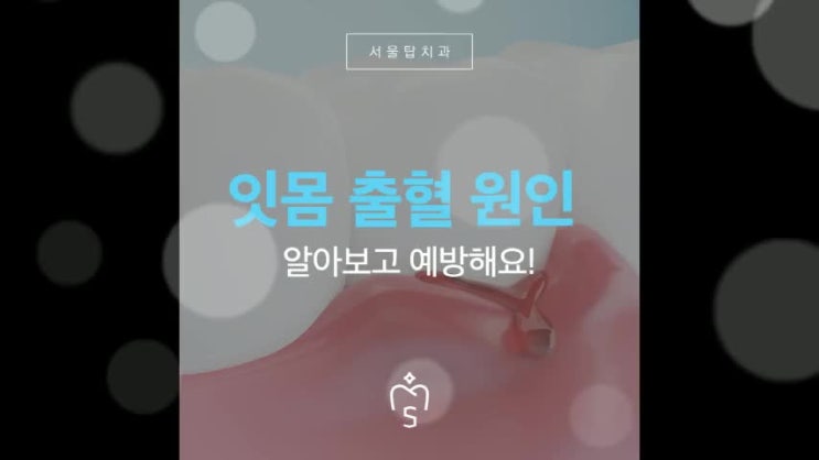 잇몸 출혈 원인, 알아보고 예방해요! : 네이버 블로그