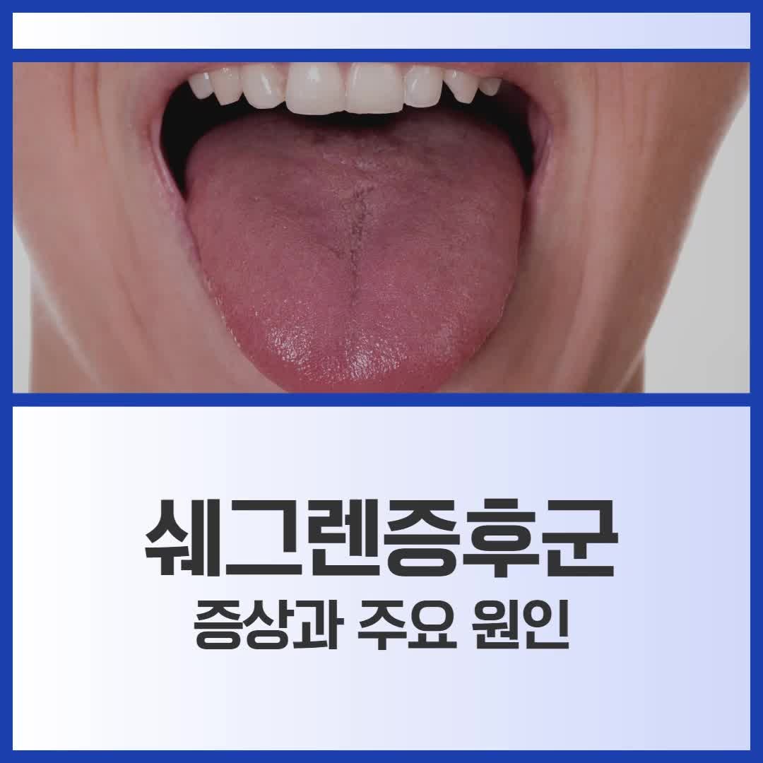쉐그렌증후군 증상과 주요 원인 면역관리 필요해요