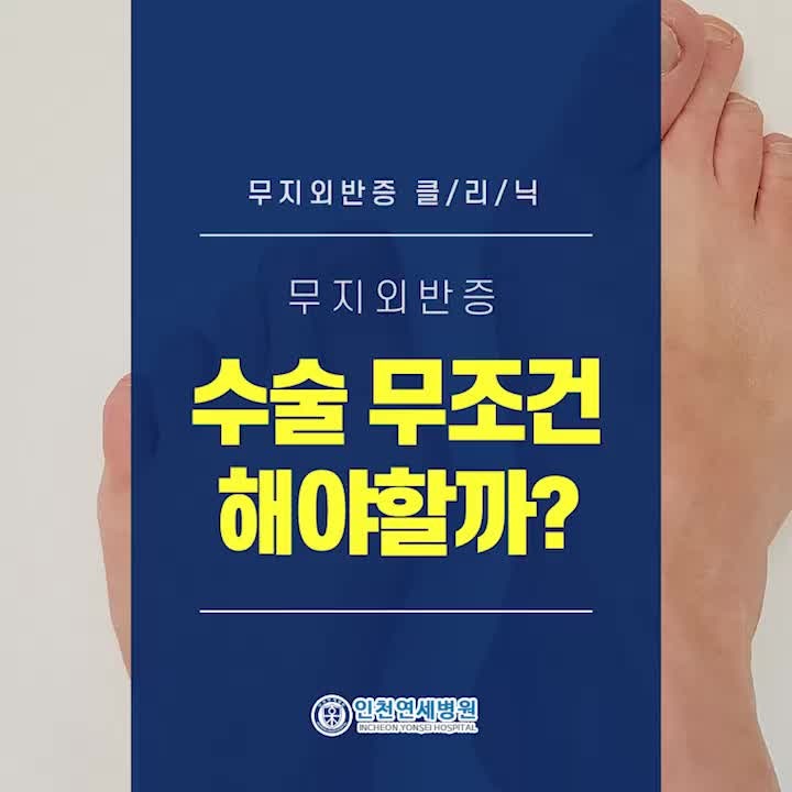 인천족부정형외과, 무지외반증수술 꼭 해야하나요?