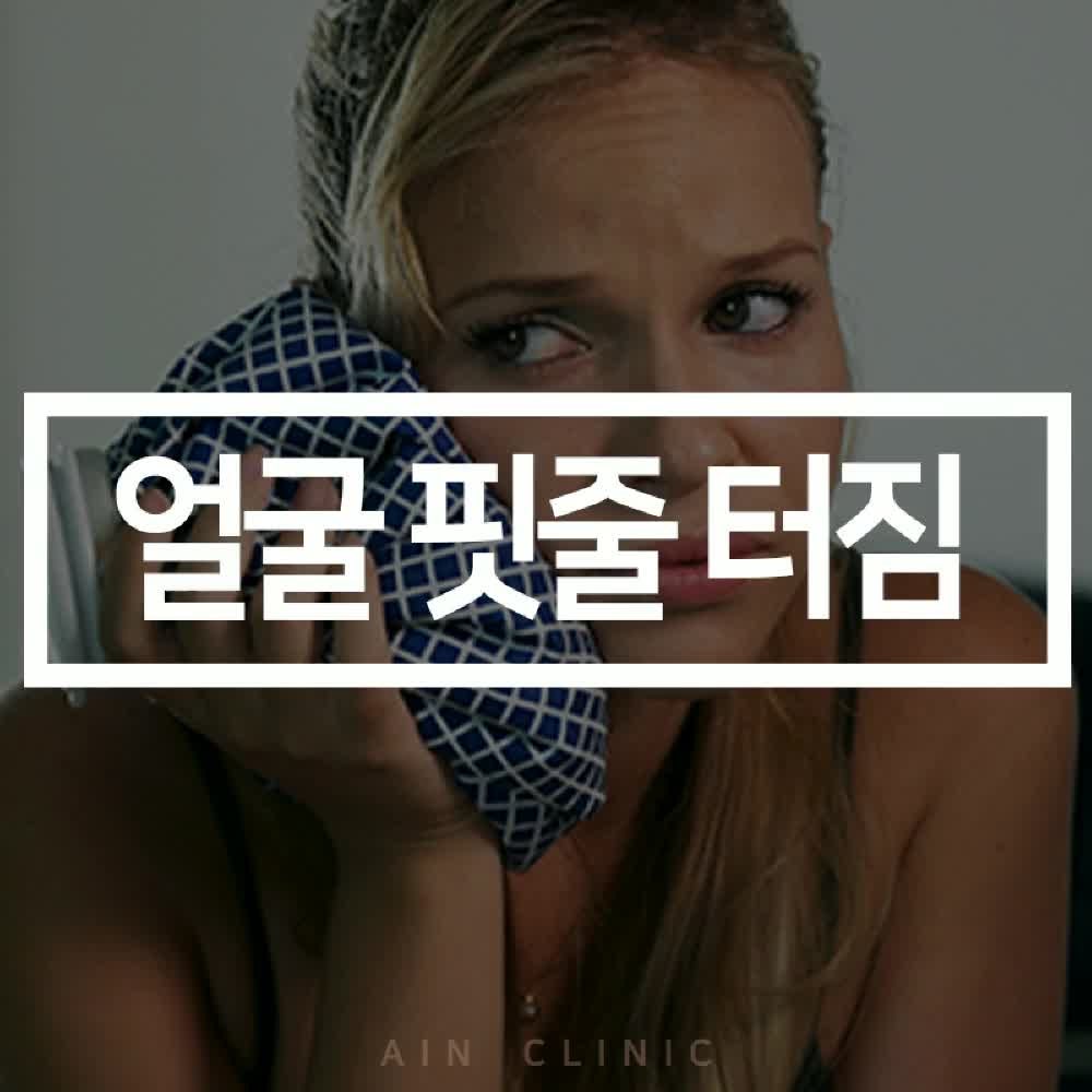 얼굴핏줄터짐 언제 돌아올까? 빨리 회복하는 법