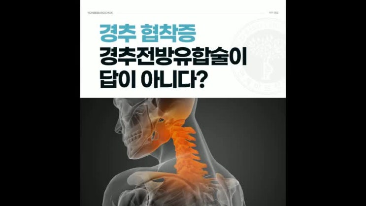 경추관협착증 경추전방유합술 답이 아니다? 대신.. : 네이버 블로그