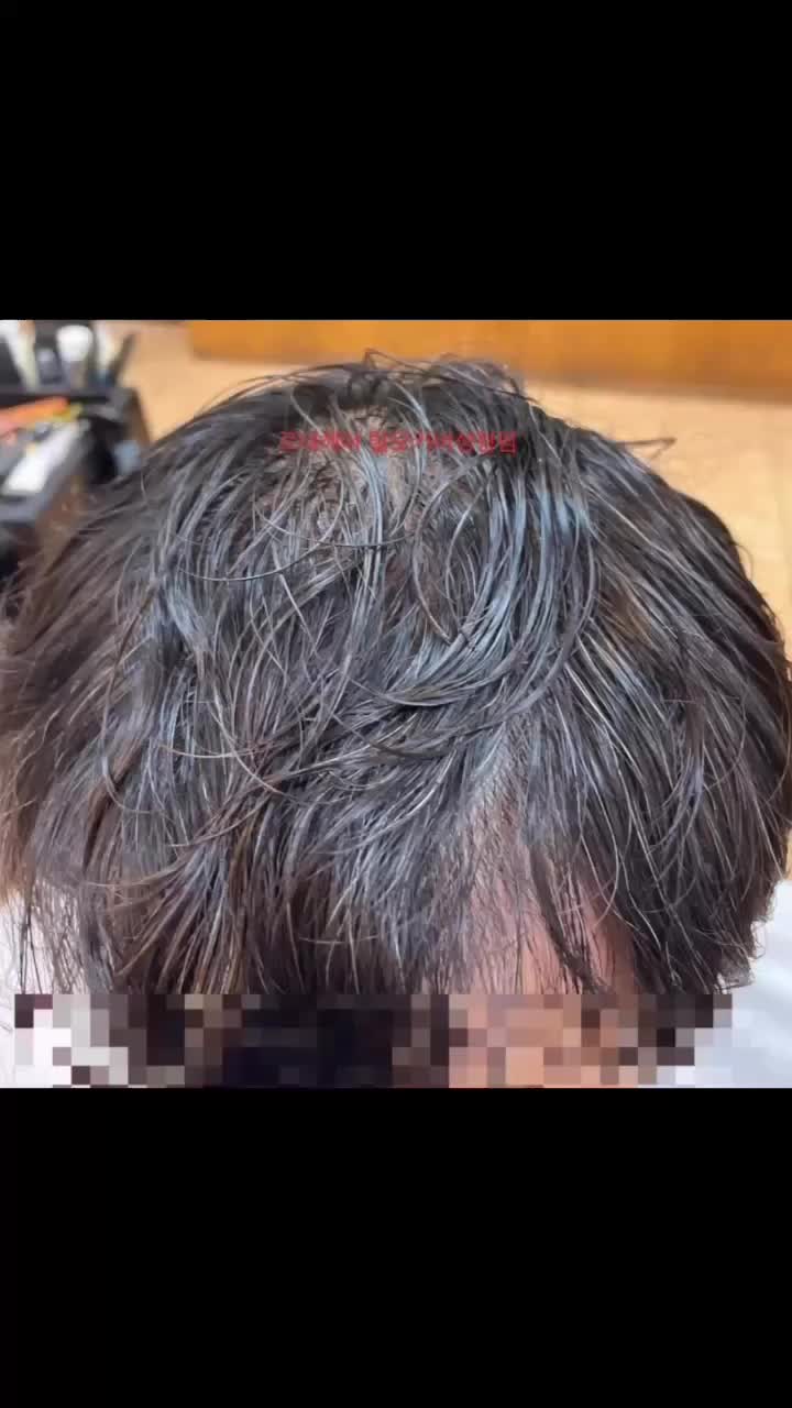  M자탈모 부분탈모 정수리탈모커버  부산사상구 남자 여자탈모성지미용실 추천 르네시떼미용실[남천동광안동전포동감전도화명동명지동당감동남포동초량동망미동반송동괘법동덕천동녹산동감만동구포동학장]