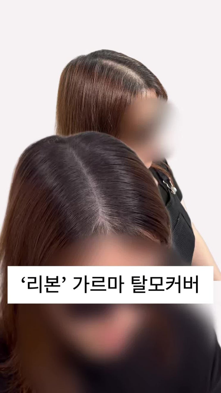 양산두피문신 / 빼곡한 가르마로 돌아가는 쉬운 방법