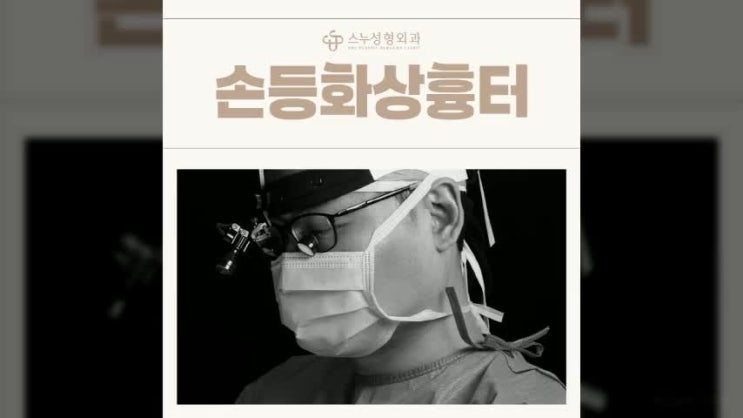  강남화상병원 진료도 보는 스누에서 손등화상 흉터 관리