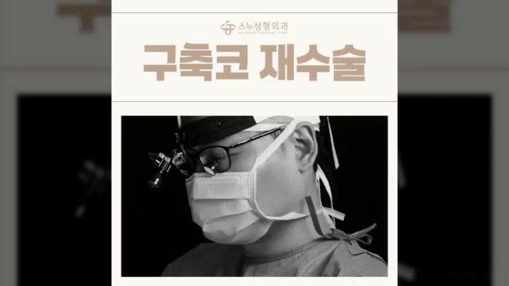  청담코성형 구축코 형성되었을 때 재수술 방법