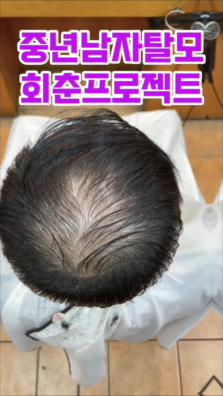  중년남자탈모회춘프로젝트 부산사상르네시떼6층 탈모헤어클리닉전문미용실