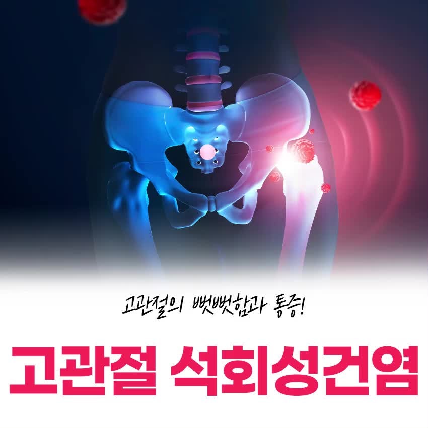 신현리 정형외과 고관절에서도 생기는 석회성건염