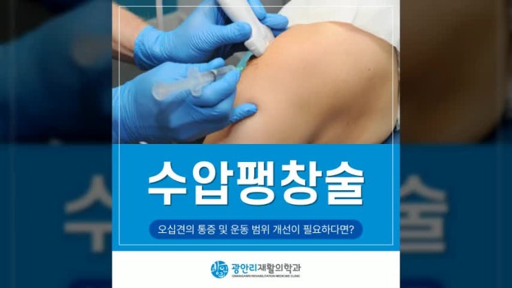  광안역정형외과 오십견에 좋은 운동과 수압팽창술 치료법