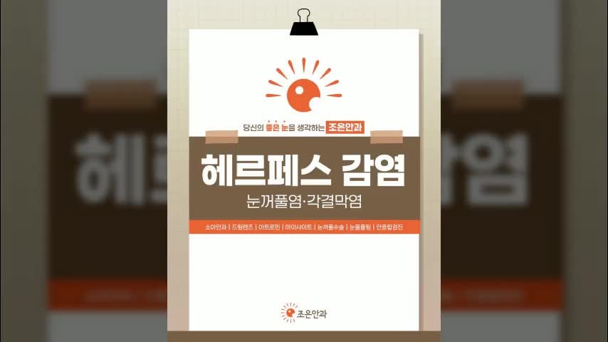 대구 달서구 월성동 안과 전염력 강한 '눈 헤르페스' 주의