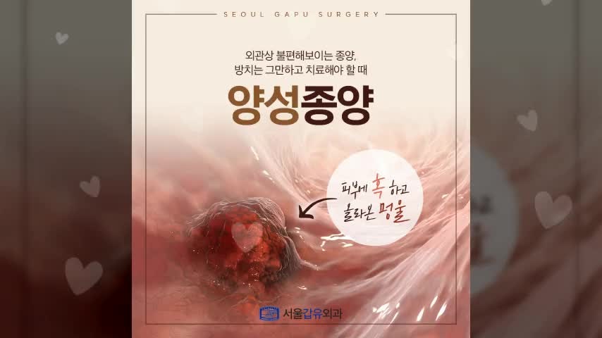 광주지방종 크기에 따라 다르다? 치료 전 알아야 할 ‘이것’