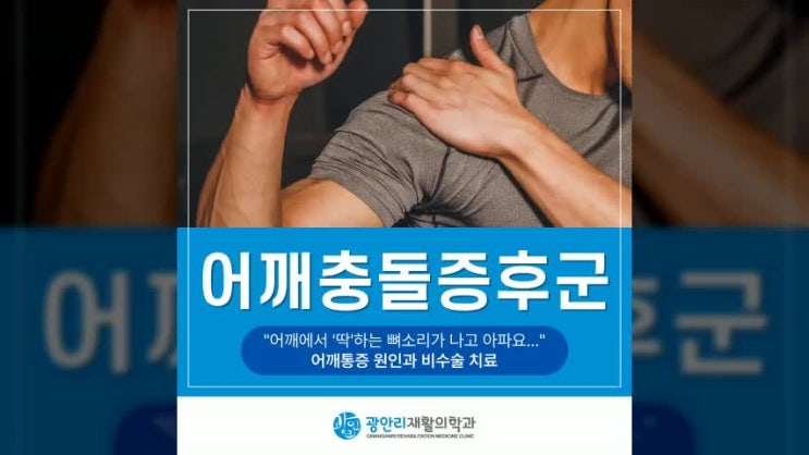  부산어깨충돌증후군 병원 어깨에서 딱 뼈소리와 통증, 원인과 비수술 치료