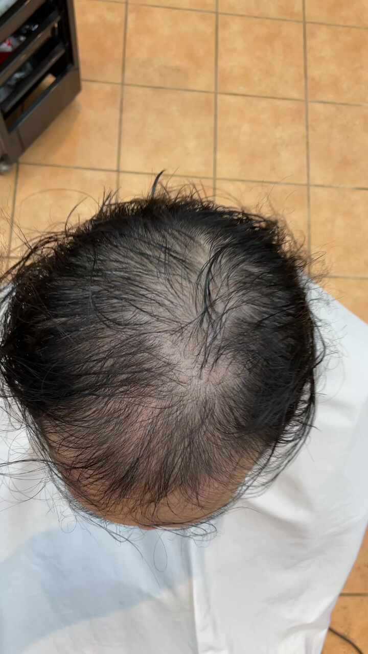  남/여 재방문많은 탈모교정성형펌 모발ㅇㅅ도 소용없을때 우린 여기만간다 부산사상르네시떼미용실