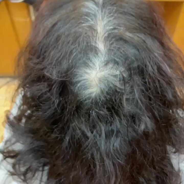  캭! 이게뭐예요? 탈모교정펌과토탈케어 심한여성탈모헤어복구는이런것! (사상감전덕포괘법덕천모라백양주례당감하단다대녹산명지에코김해장유용원진해대저가덕대연온천명륜수영망미센텀망미초읍민락남천)