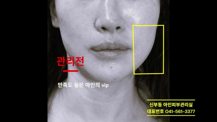  두정동윤곽관리 얼굴관리의 기본 비대칭관리 아인피부관리실