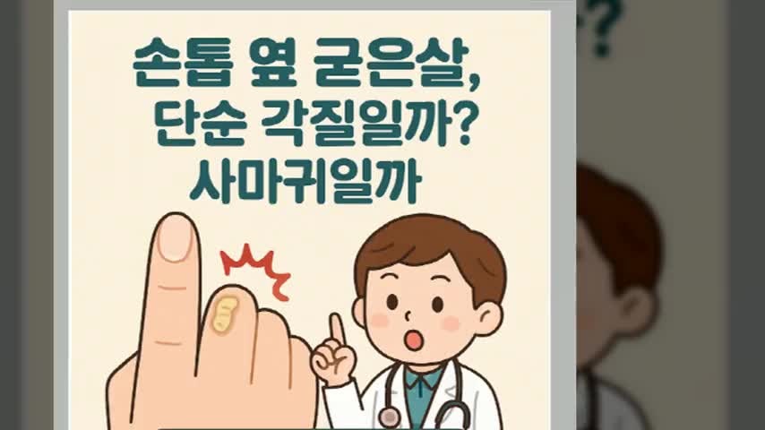손톱 옆 굳은살, 단순 각질일까? 사마귀일까?