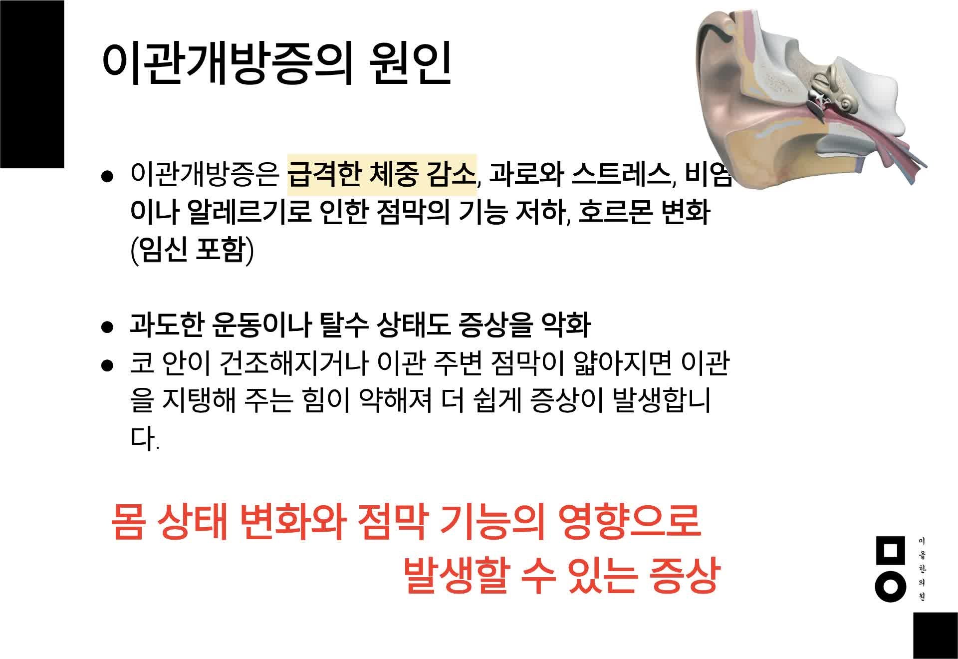 김포 이관개방증 한의원 고개를 들면 귀가 울리는 증상이 있어요