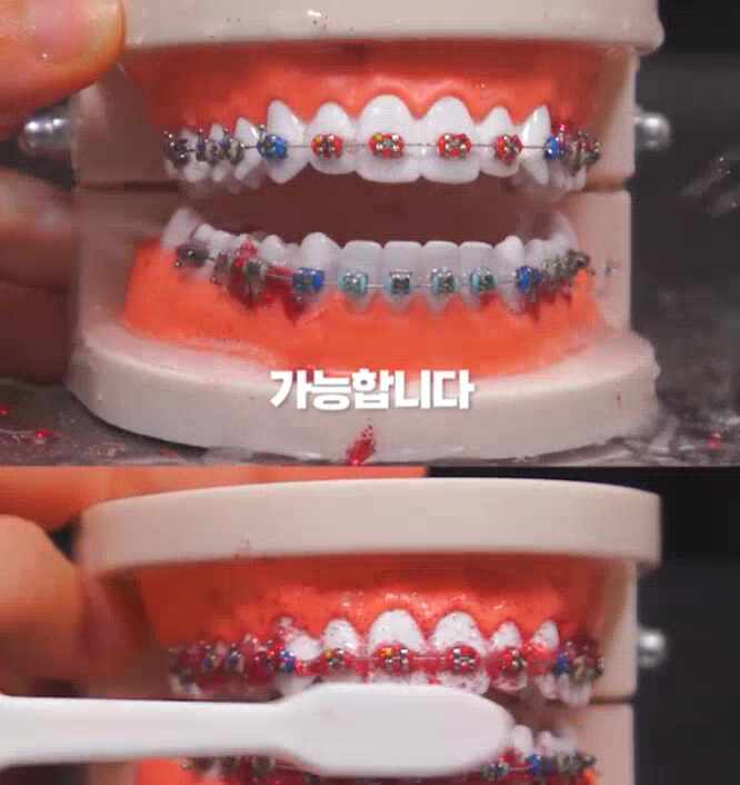  구강 치아 전동 워터 세정기 추천  물치실 무선 휴대용 기능 가성비 가격  비교 장점 총정리