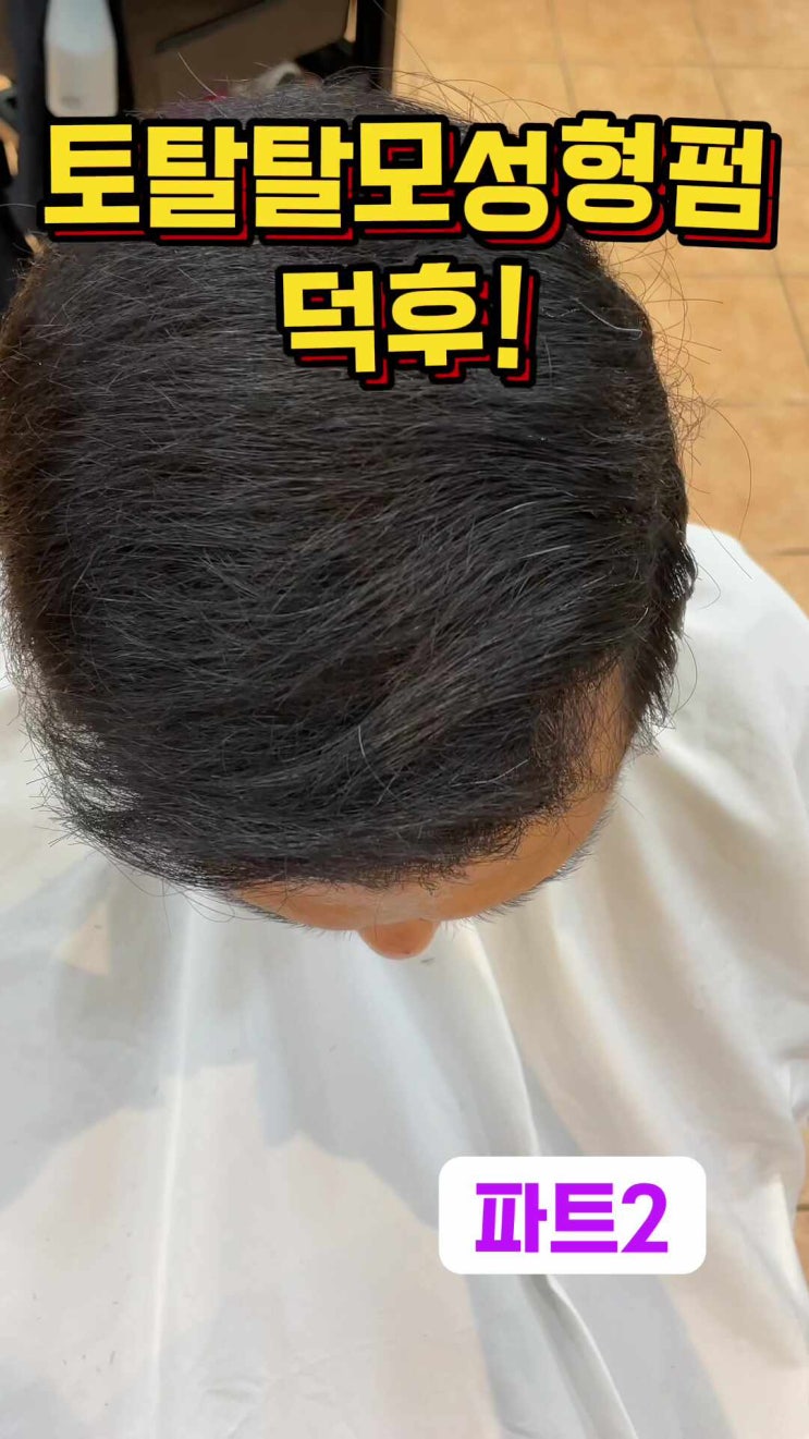  "아! 형이 왜 거기서 나와?" 탈모를 예술로 승화시키는 <탈모커버성형펌 덕후> 고객님의 '신세계' 리얼 방문기 부산사상르네시떼미용실