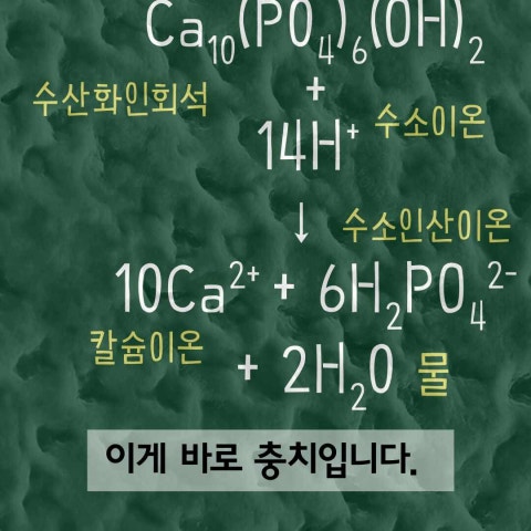 충치는 화학입니다. 그리고, 스케일링은 물리입니다.