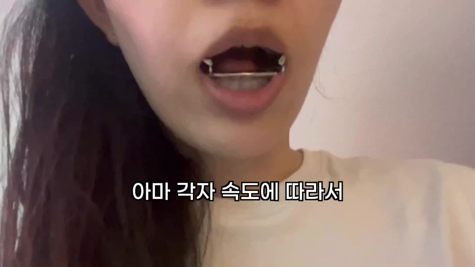 주걱턱 교정 vs 양악 수술 : 효과, 비용 기간 총정리