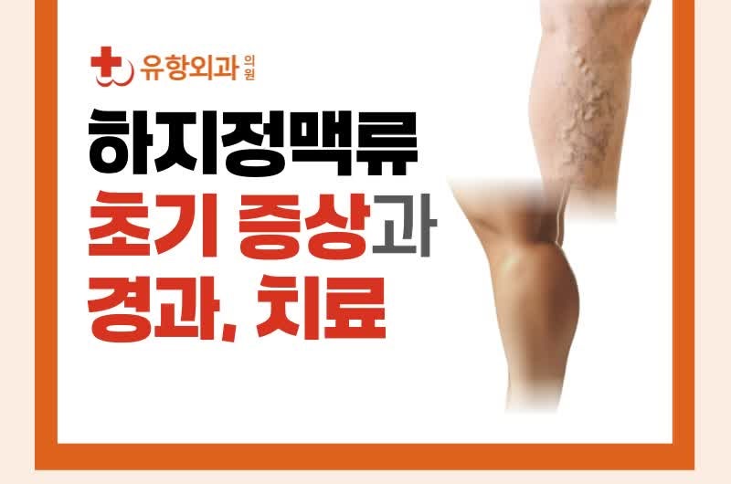 청주하지정맥류 병원 진료 권하는 다리 신호 확인하세요