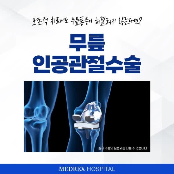 무릎수술병원 고민된다면 인공관절수술명의에게
