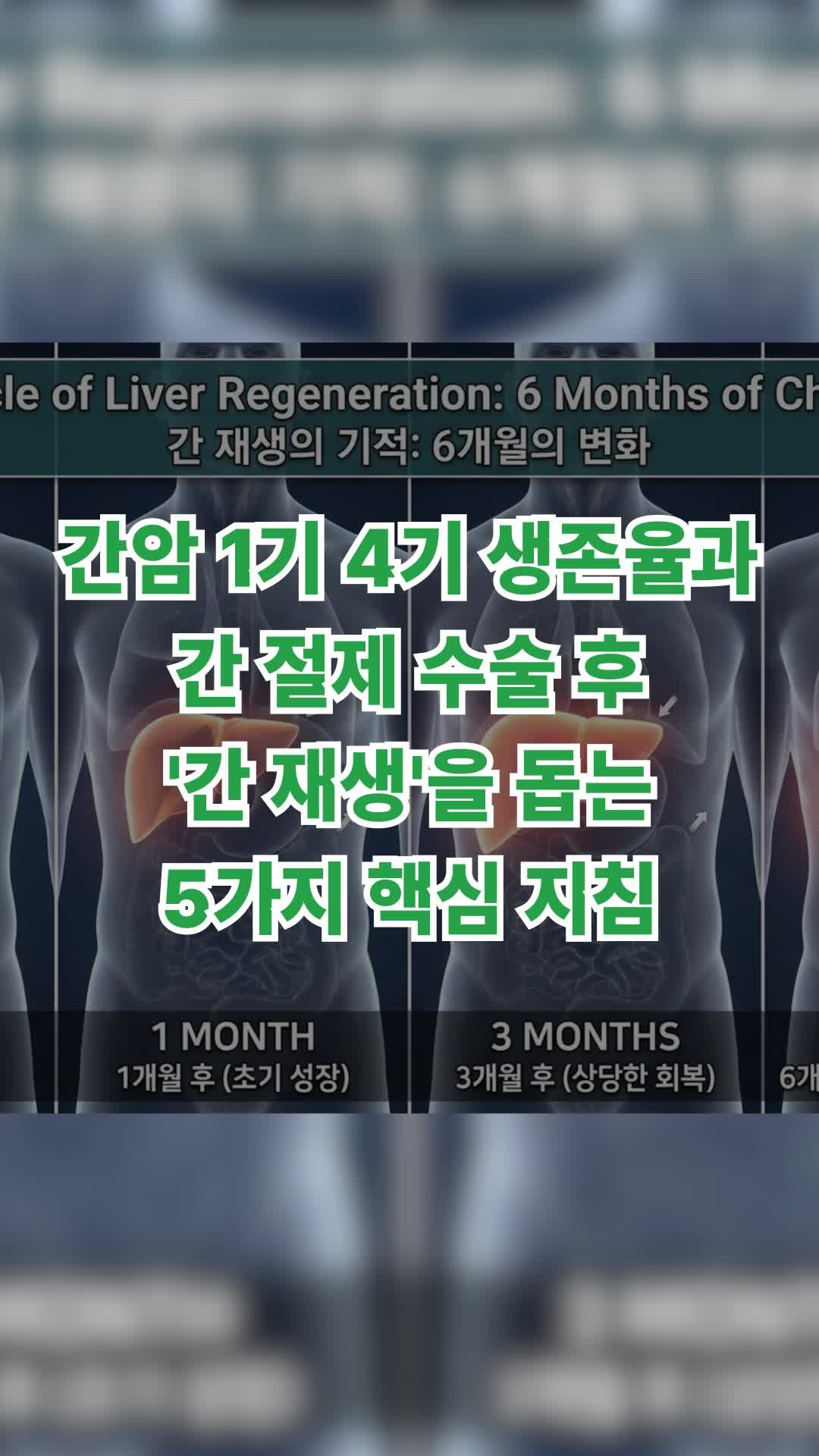 간암 1기 4기 생존율과 간 절제 수술 후 '간 재생'을 돕는 5가지
