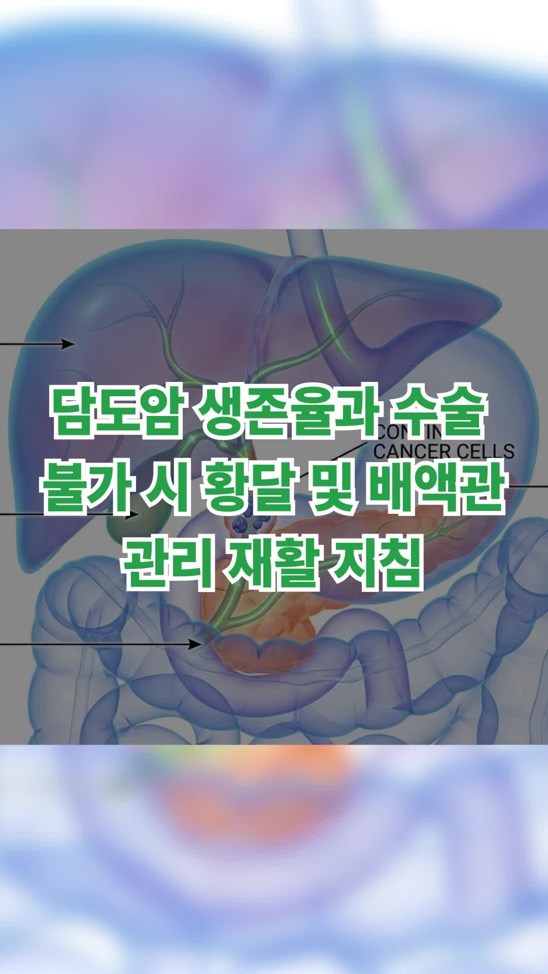 담도암 생존율과 수술 불가 시 황달 및 배액관 관리 재활 지침