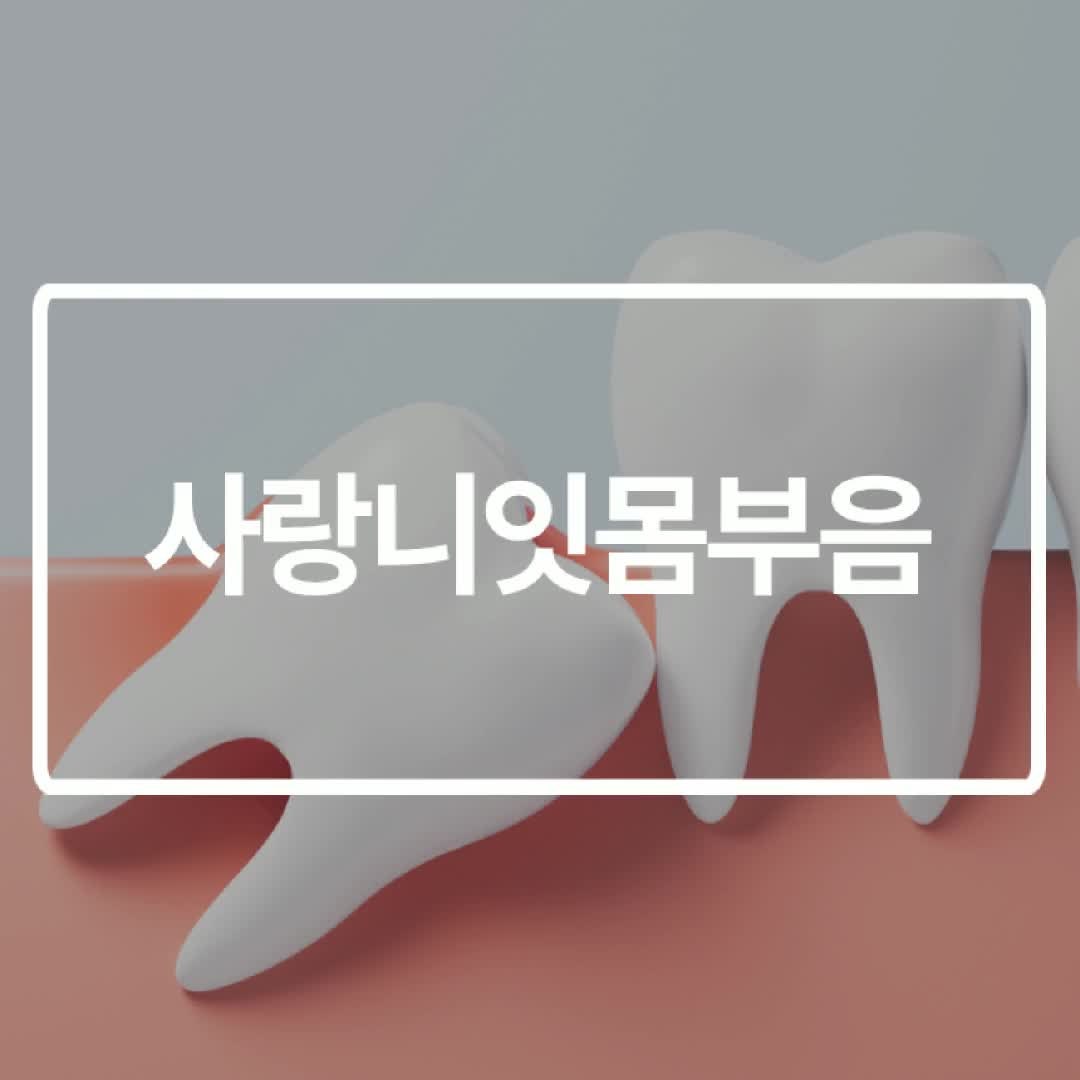 사랑니잇몸부음 약 먹으면 나아질까요?