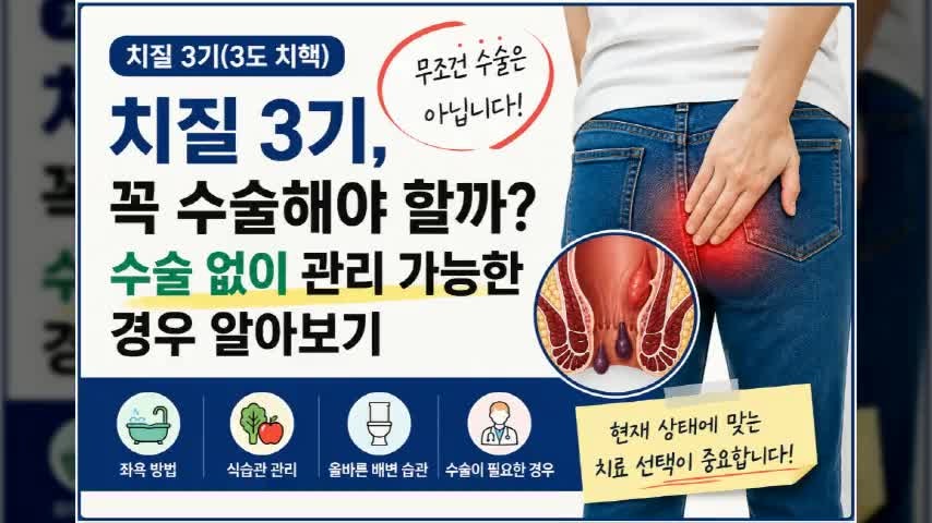 치질 3기, 꼭 수술해야 할까? 수술 없이 관리 가능한 경우 알아보기