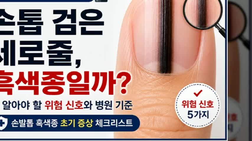 손톱 검은 세로줄, 흑색종일까? 꼭 확인해야 할 위험 신호