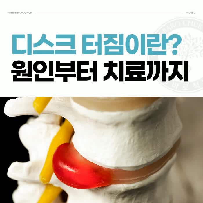 허리디스크터지면 어떻게 될까? 증상/치료 – 답십리정형외과