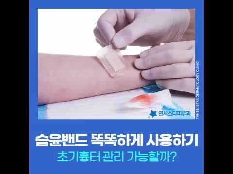 습윤밴드 교체시기 등 올바른 사용방법 초기흉터 등 예방에 도움 되는 이유
