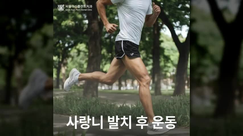 사랑니 발치 후 운동해도 괜찮을까