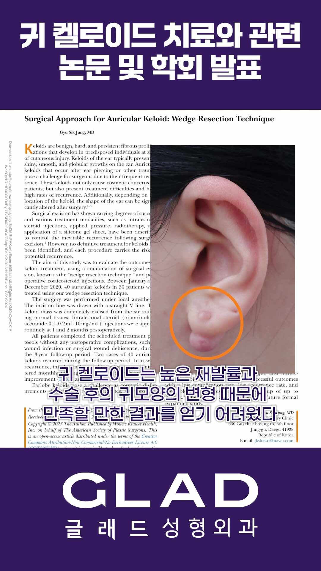 대구 켈로이드 흉터 병원 일반 흉터와 다른 치료 접근