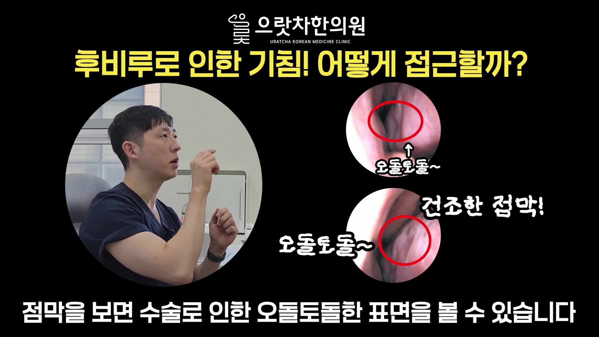 [세종시비염한의원]후비루기침어떻게 접근할까?