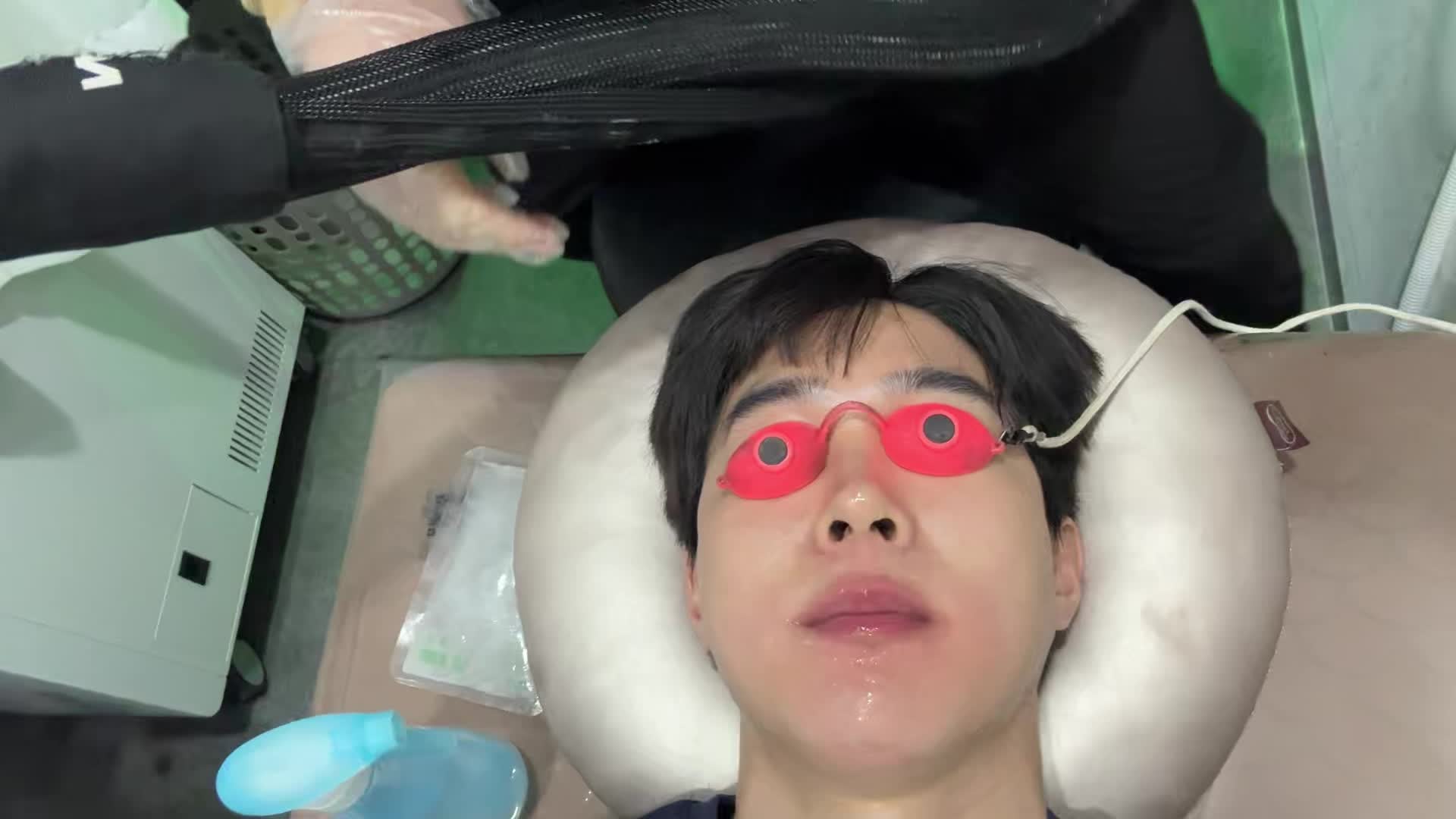 부천레이저제모 부천피부과 마지막 5회차 수염레이저제모 후기
