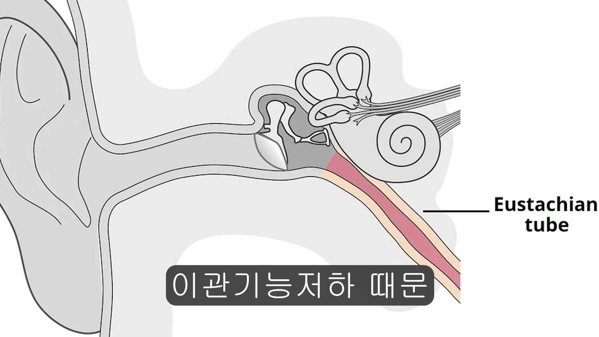 귀가 먹먹하면서 어지러운 증상의 원인은 ? (feat.강남역어지럼증)